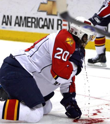 Страшная травма на хоккее